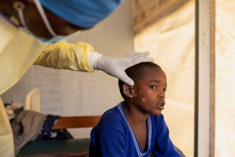 WHO Launches Global Strategic Preparedness and Response Plan to Contain Mpox Outbreak