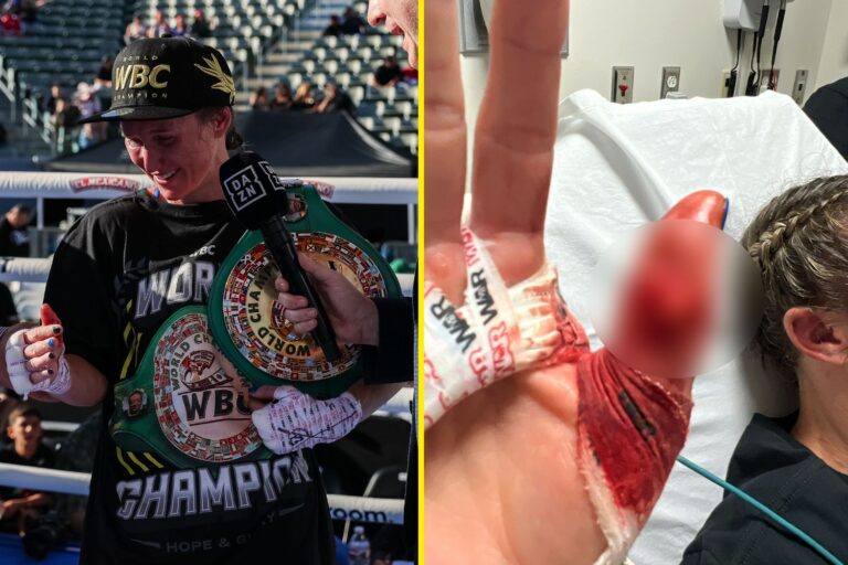 Boxer suffers horrific thumb injury in round one but still throws 497 punches to win epic title fight