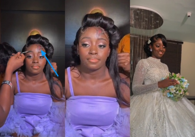 Bride Who Had An Accident Two Days To Her Wedding, Defies Odds, Weds Happily