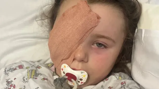 7 year old girl loses eye after battery acid from a vape being used by youths at bonfire expl0des in her face