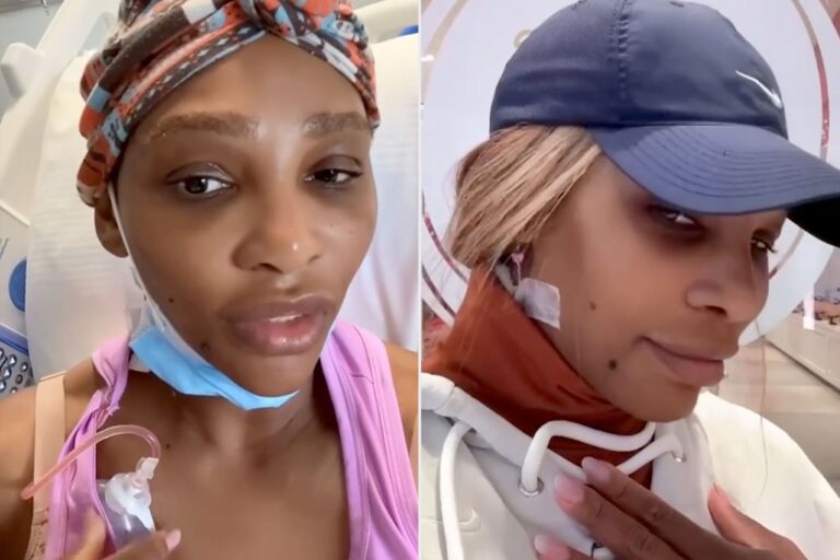 Serena Williams reveals she had surgery to remove Cyst from her neck